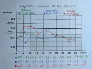 Ph Werte Urin Profil