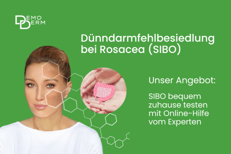Dünndarmfehlbesiedlung bei Rosacea - Jetzt zuhause auf SIBO testen - Agenki - News 02-23